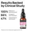 Minimalist Oil Control & Anti-Acne 10% Niacinamide Face Serum with Zinc